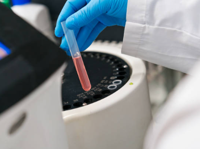 Oxidative Stress Biomarker Detection